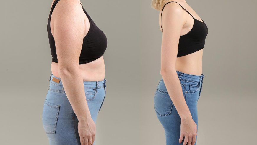 Weight-Loss-Concept-Before-and-After